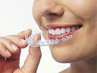 Photo of smiling woman removing Invisalign Clear Braces