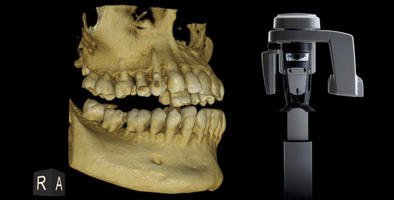 Example of 3D view of a patient jaw and digital imaging machine