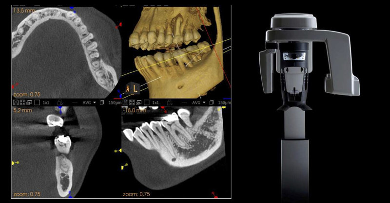 Photo of iCAT-3D machine and 3 examples of digital oral xrays